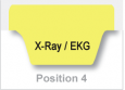 X-Ray / EKG (Lite Yellow)